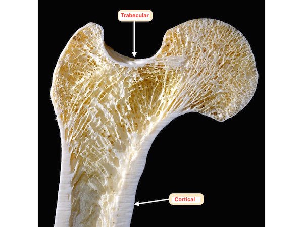 edema oseo tratamiento