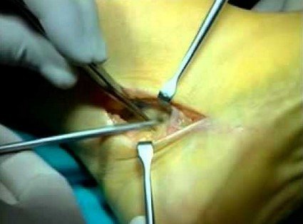 cirugia