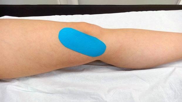 tendinitis pata de ganso tratamiento