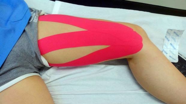 Tendinitis pata de ganso 