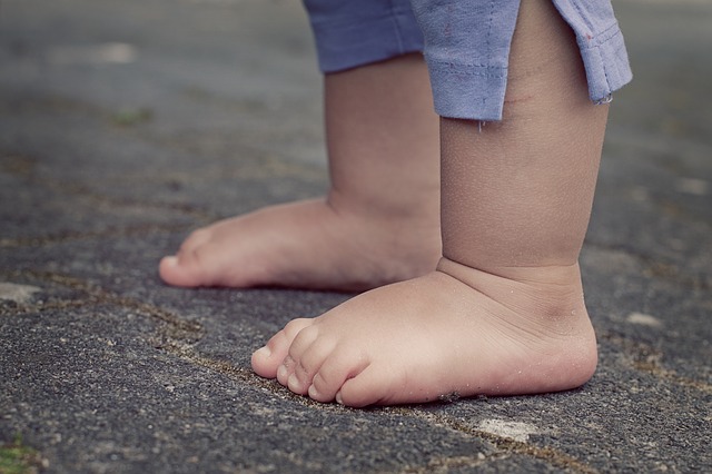 pies y calzado en niños. Pies planos