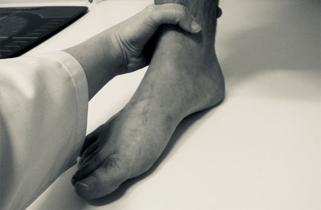 El tibial posterior puede tener múltiples afectaciones