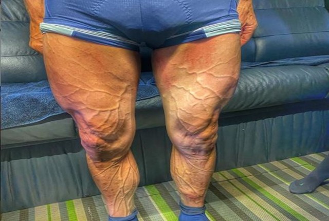 Piernas ciclista vuelta a españa