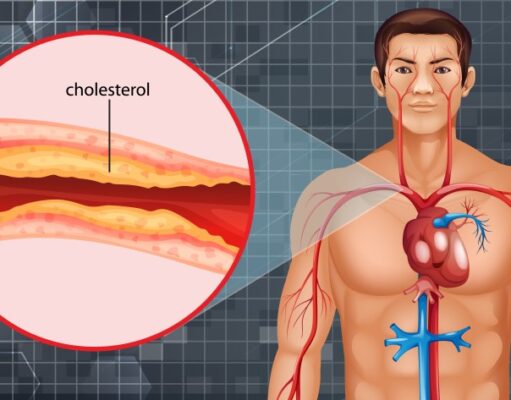 Bicicleta y colesterol