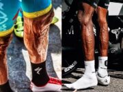 varices y ciclismo
