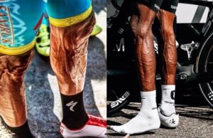 varices y ciclismo
